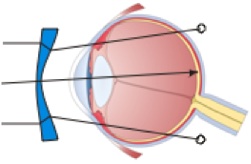 Image of the eyeball and light moving through the cornea