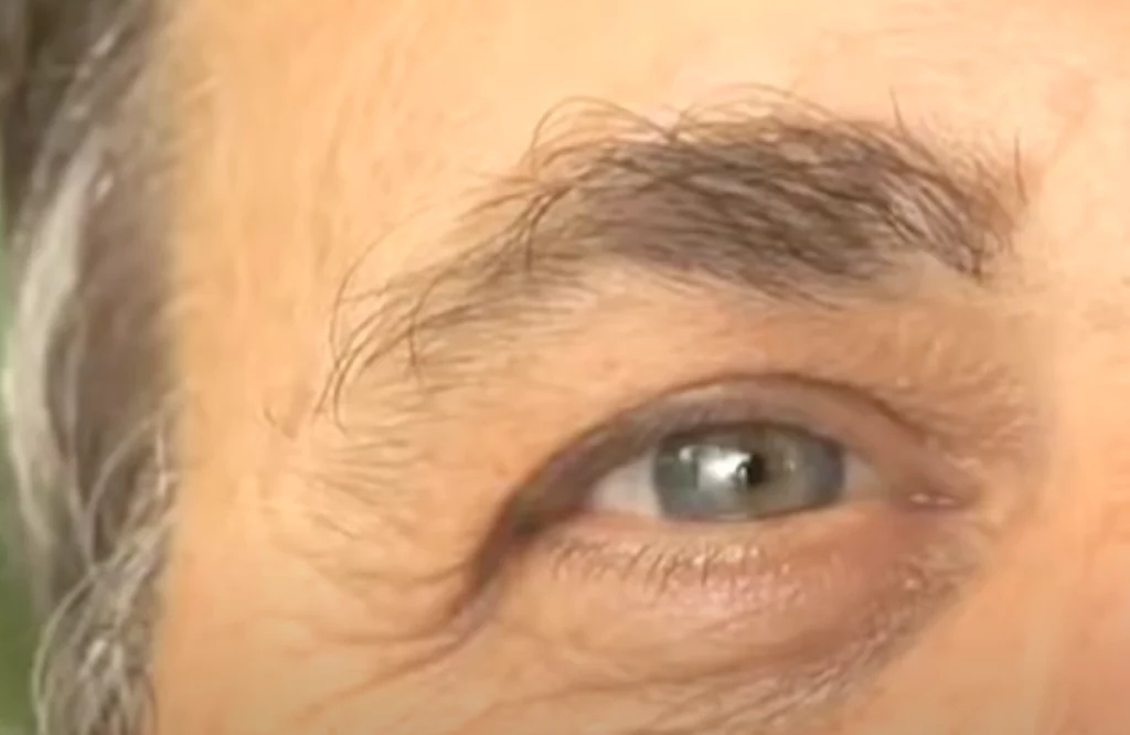 diabetic retina video poster